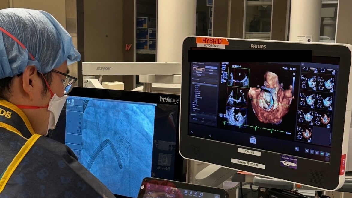 Interventionalist in scrubs, mask and cap at a cath lab console, monitors show 3D heart images