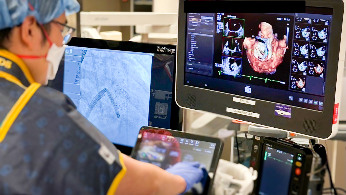 Dr. Richard Sheu guides transcatheter device implantation with real-time echocardiography.