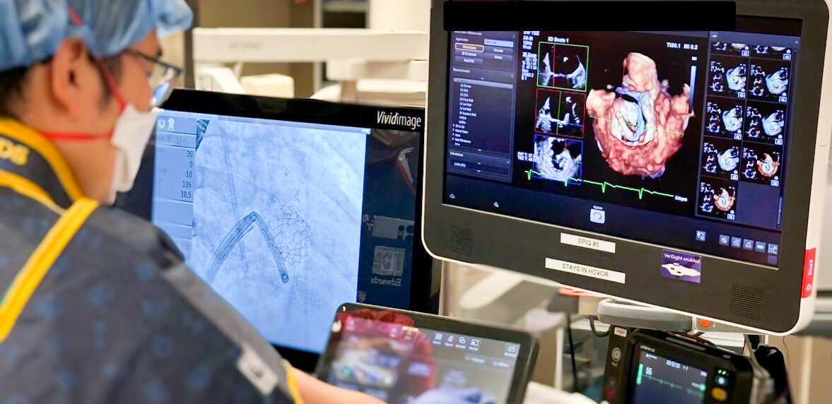 Dr. Richard Sheu observes monitors in the OR.