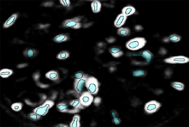 Neurons glow with fluorescent GCaMP6s, showing brain activity in an awake, freely moving mouse. A new study provides a better understanding of the neural underpinnings of reward-seeking.